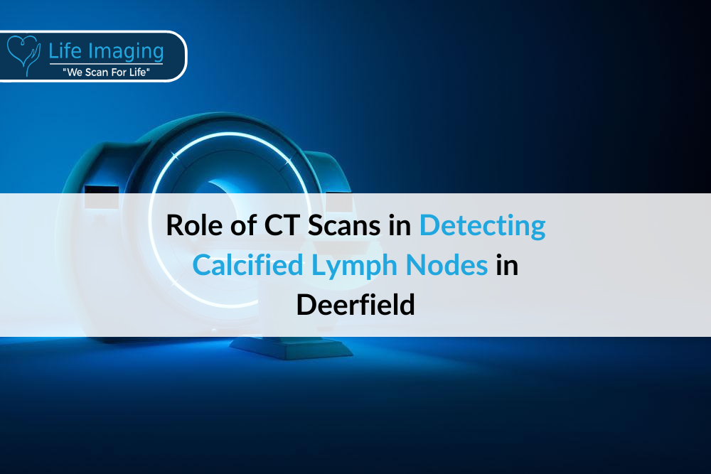 Role of CT Scans in Detecting Calcified Lymph Nodes in Deerfield