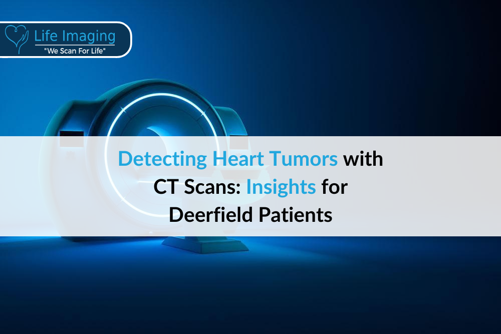 Detecting Heart Tumors with CT Scans: Insights for Deerfield Patients